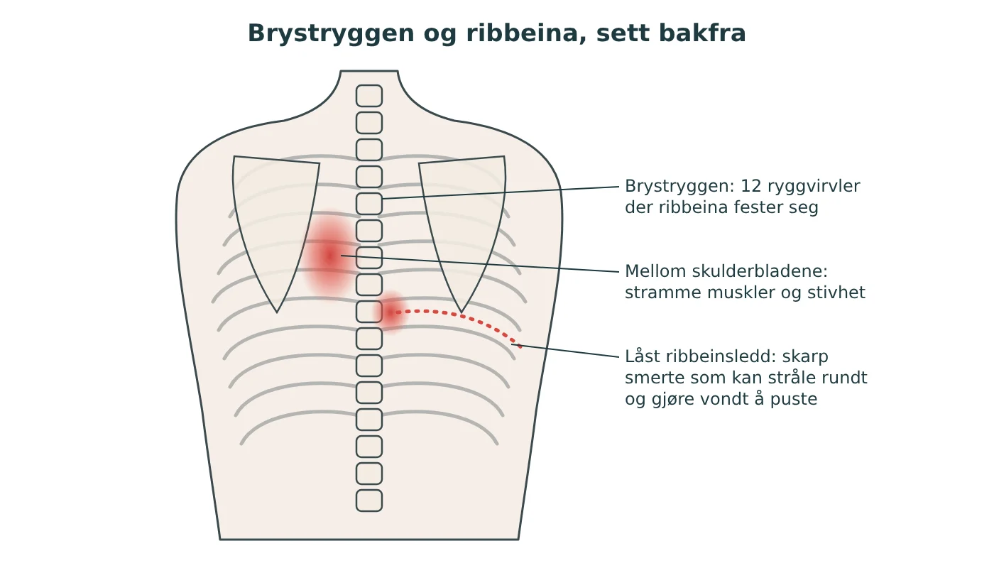 Illustrasjon av ryggen bakfra med brystryggen og ribbeina, og typiske steder for smerter mellom skulderbladene og ut langs ribbeina